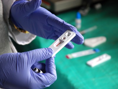 Gloved hands hold an HIV test in a lab